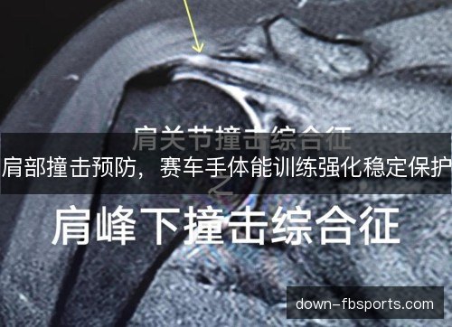 肩部撞击预防，赛车手体能训练强化稳定保护